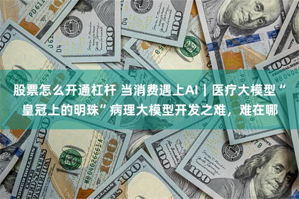 股票怎么开通杠杆 当消费遇上AI｜医疗大模型“皇冠上的明珠”病理大模型开发之难，难在哪